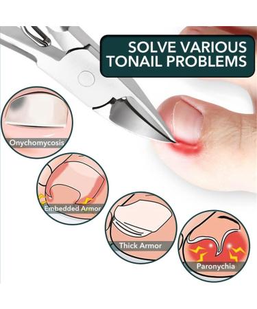 Toenail Nail Clippers Cutters Stainless Steel Pedicure Manicure Tools Professional Thick Ingrown Correction Tool Trimmer(Whitestyle) 12.5*7.5cm Whitestyle - Buy Online on GoSupps.com