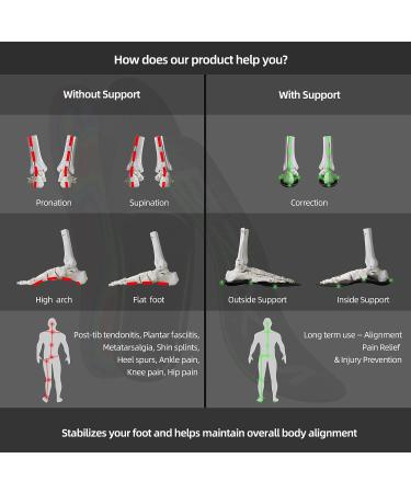 EZXM Arch Support Orthotic Custom Insoles - Plantar Fasciitis Relief - Men 9.5-10 / Women 10.5-11 - Buy Online on GoSupps.com