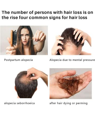Hair Growth Dense Regrowth Ginger Serum Oil Anti-Loss Treatment Spray Hair Growth Treatment Hair Loss & Hair Thinning Treatment Hair Enhancer Growth Liquid 30ML - Buy Online on GoSupps.com