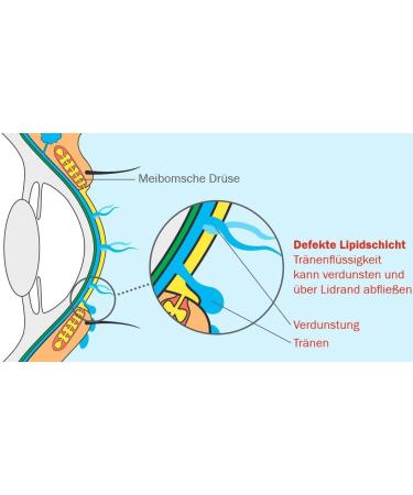 LipoNit Eye Spray Sensitive for improved hydration of irritated eyes 10 ml 10 ml 2 x 10ml 2x - Buy Online on GoSupps.com