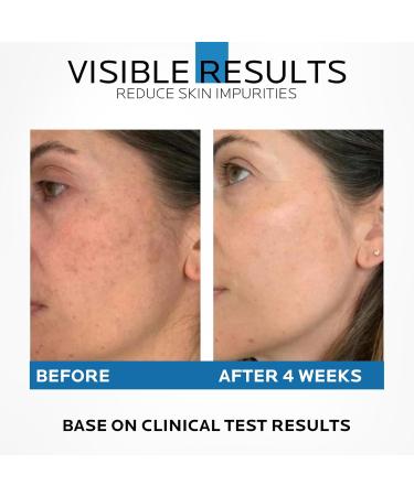 Dr. Pure Niacinamide 10% + Zinc 1% Serum - Anti-Aging Hydrating Face Serum for Smooth Glowing Skin | 2 Fl Oz - Buy Online on GoSupps.com