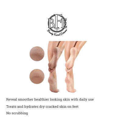 Keratosis Pilaris Exfoliating Body Lotion - 12% Lactic Acid for Smooth Skin | Immediate Moisture & Gentle Exfoliation - Buy Online on GoSupps.com
