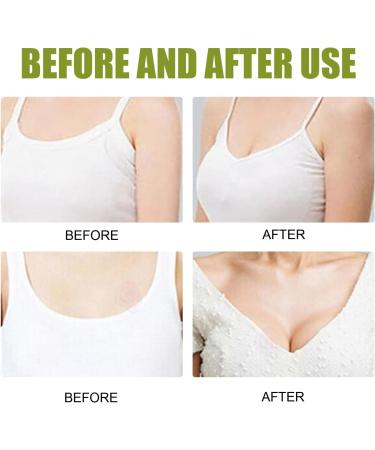 GMFLEX Breast Enhancement Patch - Enlarger & Upright Lifter - 3 Boxes - Buy Online on GoSupps.com