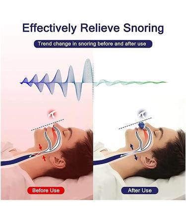 XUEMEIZI Hoseless Anti Snoring Device | Wind Speed Solution for Men and Women | Nasal Dilator Nose Vents Plugs - Buy Online on GoSupps.com