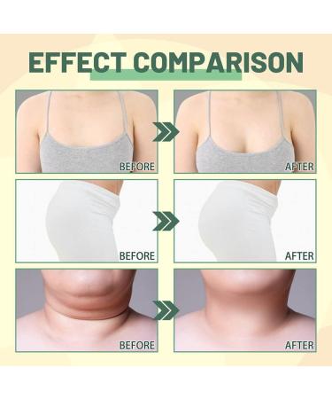 siduytin Women Slimming Body Essential Oil Girls Belly Chest Buttock Arm Thigh Lifting Nourishing for Essence Ladies Skin Care - Buy Online on GoSupps.com