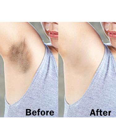 Go Ho Skin Whitening Cream | Skin Bleaching & Dark Spot Remover for Face & Body | Lightening Cream for Intimate Areas Armpits Knees & Elbows | 1.06oz - Buy Online on GoSupps.com