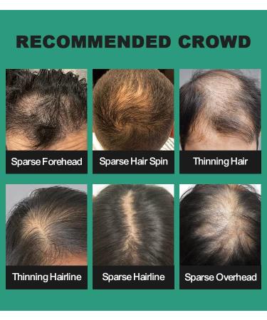 UOYOU Medium Brown Hair Fibres 27.5g Bottle with Applicator | Hair Loss Concealer for Men and Women | Natural Keratin Hair Building Powder - Buy Online on GoSupps.com