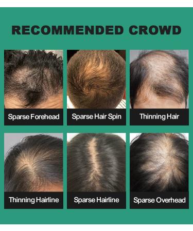 Uoyou Gray Hair Fibers - Natural Keratin Hair Loss Concealer for Men & Women (27.5g) - Non-Detectable Thinning Hair Solution - Buy Online on GoSupps.com