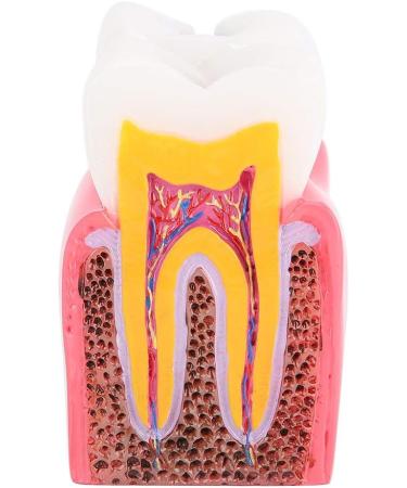 Buy Caries Comparison Study Models | Dental Anatomy Teeth Models for Dentist Education - International Shipping - Buy Online on GoSupps.com