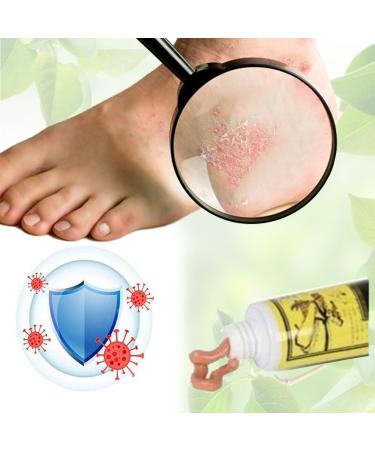 LDZJHTYY Natural Anti Itch Cream - Relief for Itchy Skin, Redness, Dermatitis & Eczema - 4pcs - Buy Online on GoSupps.com