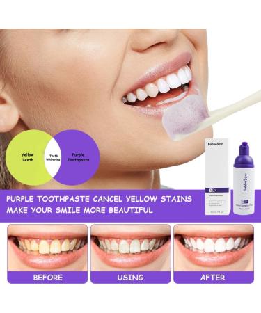 ACWOO Purple Tooth Whitening Toothpaste Teeth Cleaning Toothpaste Foam Toothpaste Stain Removing Tooth Purple Tooth Whitening Toothpaste for Sensitive Teeth and Yellow Teeth Clean 60ml Mousse Type - Buy Online on GoSupps.com