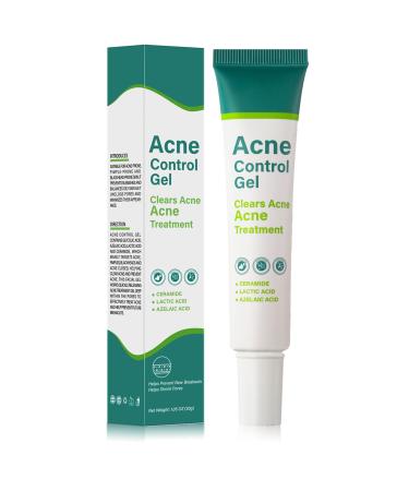 Anti Acne Face Cream Spot Cream For Acne Treatment & Spot Treatment Pimple Treatment Gel Reduces Redness & Moisturiser Acne Cream For Face Blemishes and Blackheads.