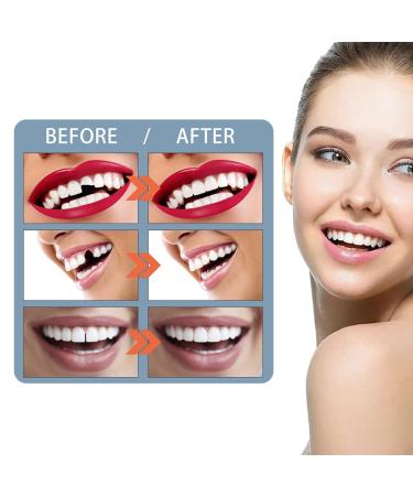 Provisional Dentures & Temporary Tooth Repair Set - Vampire Fake Dentures | International Shipping - Buy Online on GoSupps.com