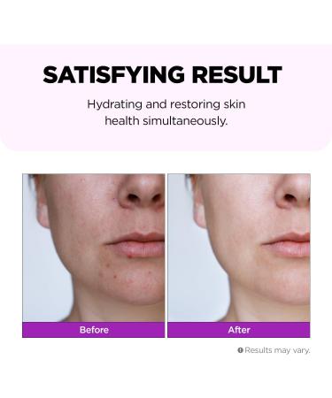 Superfood for Skin Hyalusteen Repair Toner - Hydrating Korean Skincare & Soothing Facial Toner (150ml - Buy Online on GoSupps.com
