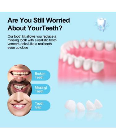 Smile Teeth Veneers - 50 Premium Temporary Crowns for Bad Tooth Coverage | Fast Styling & Healthy Materials | Includes Storage Box - Perfect for Cosmetic Dentistry - Buy Online on GoSupps.com