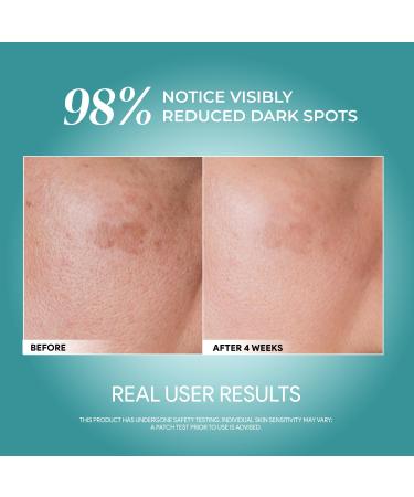 Advanced Youth Rejuvenating Serum with 10% Niacinamide + Arbutin Brightening & Dark Spot Treatment 50ml - Buy Online on GoSupps.com