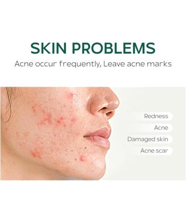 Acne Cream - Tea Tree Oil Anti Acne Removal Cream For Acne Treatment And Spot Treatment - Spot Cream For Acne & Spot With Herbal Extract - Face Blemishes & Blackheads Fade Acne Spots Shrink Pores - Buy Online on GoSupps.com