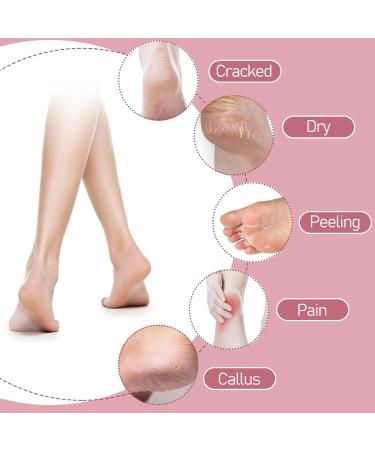 Sibba 4 Pairs Moisturizing Gel Heel Socks Cracked Heel Gel Lined Infused Toeless Spa Socks for Women Soft Cotton Silicone Ventilate Heel Sleeves Open Toe Foot Care Treatment Overnight (Multicolor) 4 Pairs Black+Pink+Gray+Green 4.0 - Buy Online on GoSupps.com