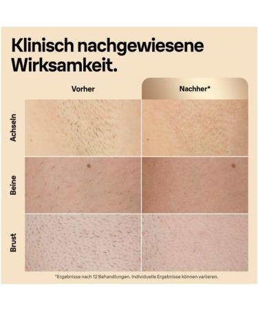 Braun IPL Silk Expert Pro 5 Hair Removal Device for Women - Effective & Safe Laser Alternative 4 Attachments Designed in Germany - PL5382 - Buy Online on GoSupps.com