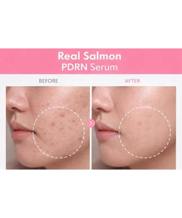PDRN Peptide Repair Serum High-Purity Salmon DNA Peptide Complex Niacinamide Hydrating & Firming Facial Serum Made in Korea PDRN & Peptide Complex - Buy Online on GoSupps.com