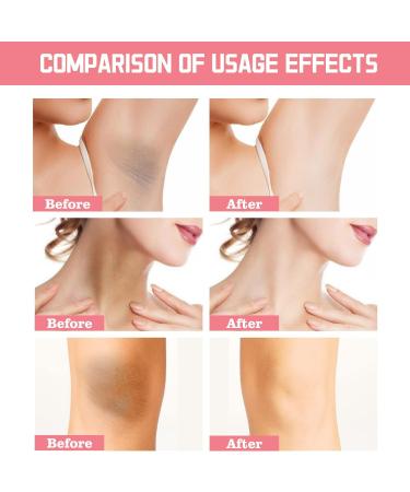  MagiSel Underarm whitening cream whitening cream body whitening cream whitening for underarms elbows sensitive and private areas whitens nourishes - Buy Online on GoSupps.com