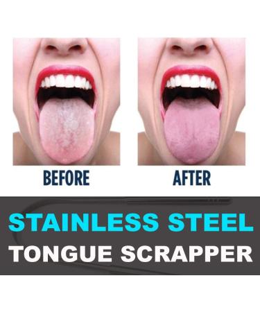 Premium Stainless Steel Metal Tongue Scraper for Oral Health - Eliminate Bad Breath & Clean Toxins - Buy Online on GoSupps.com