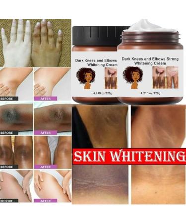 120g Crema Para Aclarar Las Axilas Y Partes Intimas Crema Aclaradora Para Piel Manchas En Cara Axilas Cuello Entrepierna Crema Blanqueadora Para Partes Intimas - Buy Online on GoSupps.com