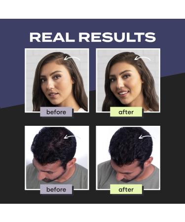 Toppik Dark Brown Hair Building Fibers - Thinning Hair Thickener for Fuller Appearance - 0.42 OZ - Buy Online on GoSupps.com