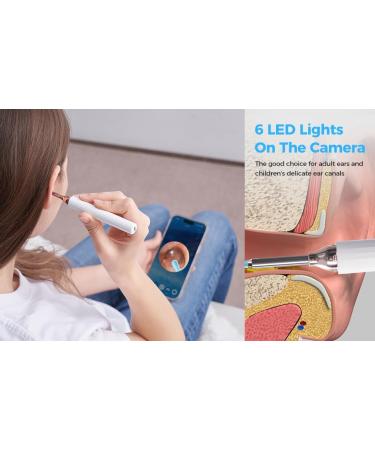 CLARITYEARS Ear Wax Removal Kit with Camera 1080P HD 6 LED Otoscope Ear Cleaner Earwax Removal Tool with App USB-C Rechargeable Ear Cleaning Kit for Adults and Kids - Buy Online on GoSupps.com
