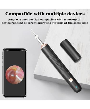 TopQuaFocus Earwax Removal Kit - Electric Otoscope with 6 LED Lights & 1000P HD Camera | Wireless Ear Scope for Kids & Adults | Easy Ear Cleaning & Pediatric Wax Remover - Buy Online on GoSupps.com