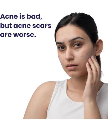  G n rique VK Pitstop Blue Copper Peptide Serum Repairs Acn Scars & Pitted Marks Evens Skin Tone & Reduces Blemishes For All Skin Types 25 Ml - Buy Online on GoSupps.com