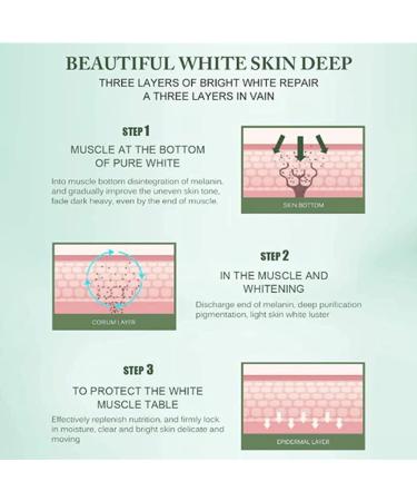  JPSDOWS Whitening Freckle Cream - 20g Anti-Freckle Cream Anti-Plant Cream - Buy Online on GoSupps.com