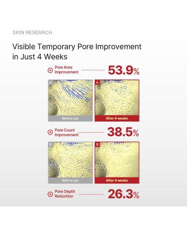 TERAPIC Repair Lifting Shot 300 Korean Skin Booster Serum with Micro EC-Spicule Clinically Tested for Pore Care, Wrinkle Reduction & Skin Elasticity (50ml) - Buy Online on GoSupps.com