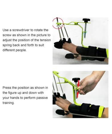 Finger Wrist Corrector | Orthopedic Stabilizer for Physiotherapy & Injury Prevention - Dynamic Support for Knees - Buy Online on GoSupps.com