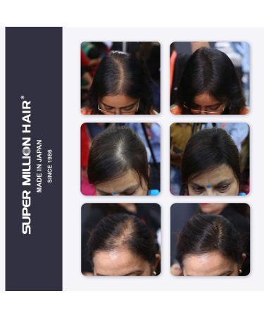 Super Million Hair 15g - No.2 Dark Brown: Instant Hair Loss Concealer - Buy Online on GoSupps.com