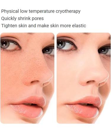 Tuecota Ice Roller - Face & Eye Puffiness Relief | Skin Roller for Brightening, Pore Shrinkage & Wrinkle Reduction | Tighten Skin & Pain Relief Massage Roller - Buy Online on GoSupps.com