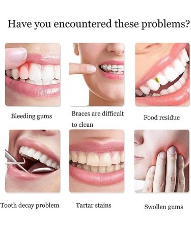 Water Flosser | Portable Electric Oral Irrigator with 3 Nozzles | Waterproof & Space-Saving | Ideal for Home Office & Travel - Buy Online on GoSupps.com