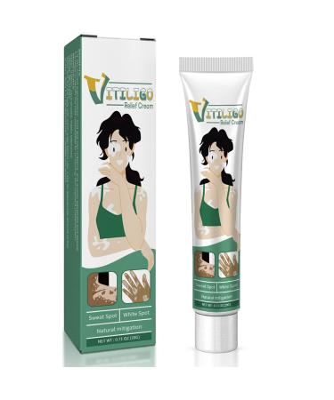 Vitiligo Cream  Natural Vitiligo Treatment for Skin Vitiligo  Vitiligo Care Cream-Reduce White Spots and Improve Skin Pigmentation  Easy to Apply