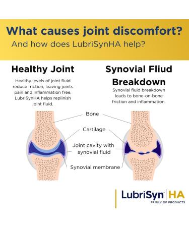 Lubrisyn Hyaluronic Acid Oral Joint Supplement Liquid HA Formula for Humans Promotes Joint Support Mobility Flexibility Hydration & Healthy Function for Men & Women Grape Flavor 11.5oz - Buy Online on GoSupps.com