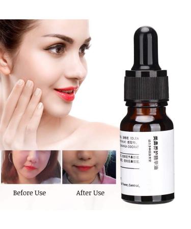 Essential Nose Repair & Reshaping: Magic Nose Up Lifting Shaper for Perfect Contours - Buy Online on GoSupps.com