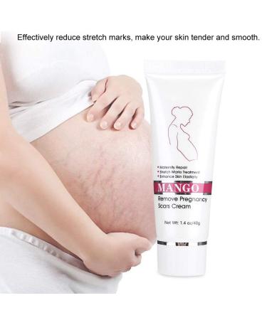 Stretch Mark Cream - Effective Pregnancy & Scar Treatment | Elimina Estr as - Buy Online on GoSupps.com