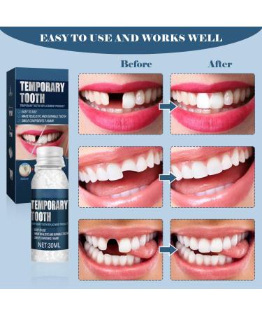 Temporary Tooth Set Tooth Repair Kit Temporary Teeth Replacement Kit for Chipped Teeth Moldable False Teeth Temporary Filling for Tooth - Buy Online on GoSupps.com