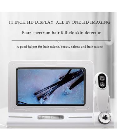 Skin Diagnosis Analyzer Hair Follicles Scalp Detector with 14.5 Inches HD Screen Configuring Dual Probes 200x 50x Four-Picture Comparison for Beauty Salon Hair Salon - Buy Online on GoSupps.com