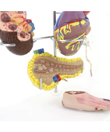 Model Model of Diabetes Complications Heart Pancreas Brain Neuron Model Foot Medical Communication Aids for The Diabetes Demonstration - Buy Online on GoSupps.com