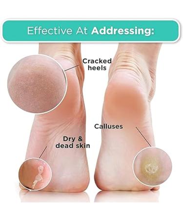 Lot de 3 paires de masques exfoliants l'ur e - Traitement hydratant pour les pieds secs et craquel s et les callosit s - Sans danger pour la peau pour les pieds doux de b b - Homme et femme - Buy Online on GoSupps.com
