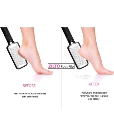 Zilto Professional Foot File for Foot Care Foot Scrubber Foot Scrapper and Double Sided Foot Files For Hard Skin - Callus Remover Hard Skin Remover 3 in 1 Pedicure Set - Buy Online on GoSupps.com