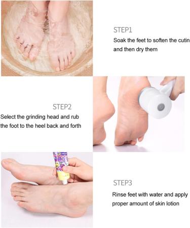 Silkn Vacupedi Corn Remover for Feet 23 15 8 USB Rechargeable Pedicure Tool Automatic Callus Dead Skin Remover Adjustable Foot File - Buy Online on GoSupps.com