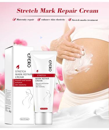 Effective Stretch Marks Removal Cream for Women Targets Pregnancy & Acne Marks Moisturizes & Firms Skin - Buy Online on GoSupps.com