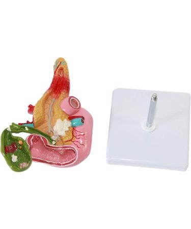 Duodenal Biliary and Pancreatic Model - Duodenal Model - Gallbladder Pathology Digestive System Model Tool Science Teaching Toy Model - Buy Online on GoSupps.com