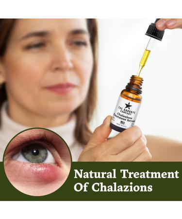 Chalazion Remover & Stye Eye Treatment - USA Made (15ml) - Buy Online on GoSupps.com